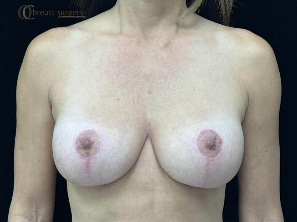 AFTER(1) AFTER(1)