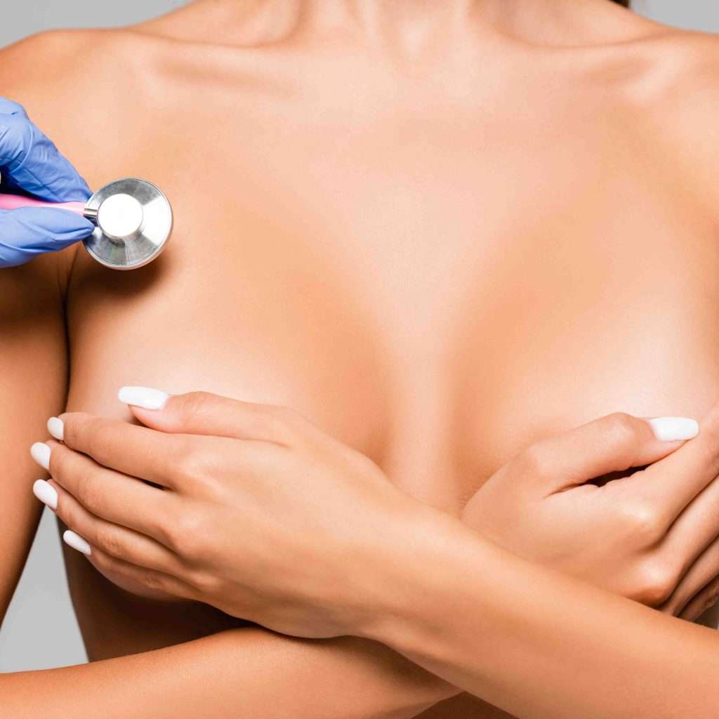 Breast augmentation large implants