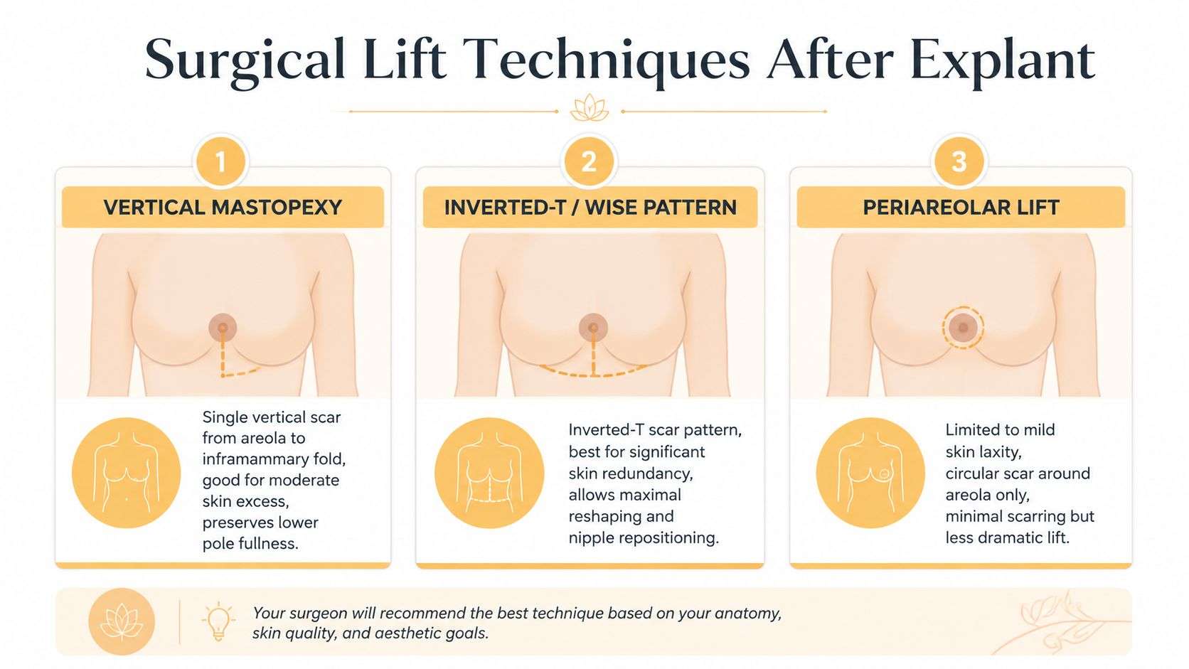 An infographic illustrating three surgical breast lift techniques after explant: vertical mastopexy, inverted-T, and periareolar lift.